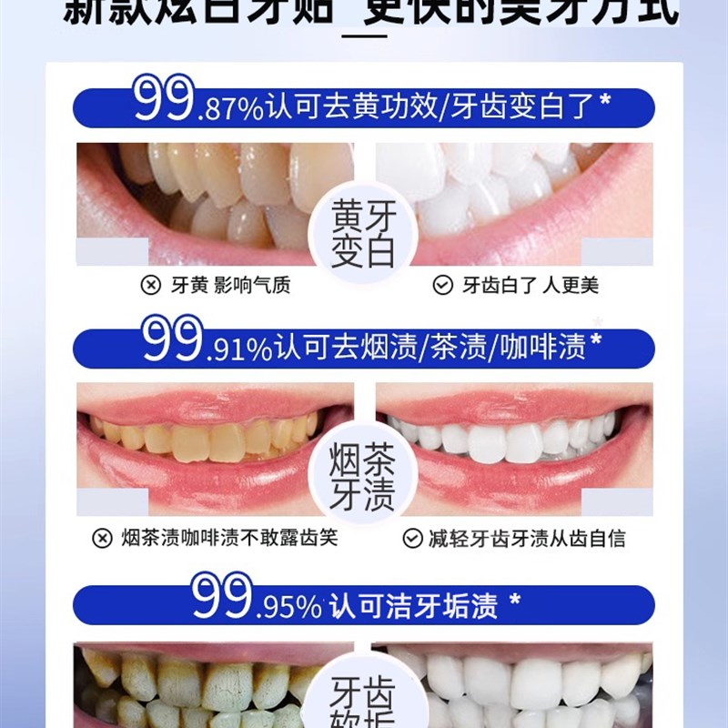 牙齿牙贴美白去黄洁白非速效黄牙烟茶渍炫白亮白美版神器酵素锁白