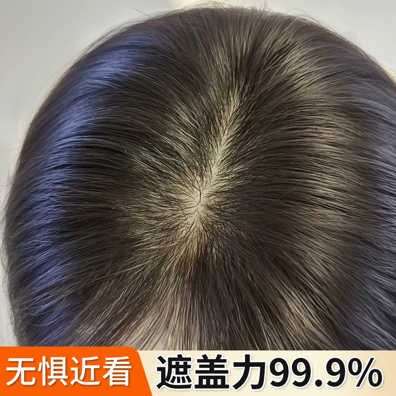 假发女片头顶轻薄无痕遮白发蓬松增发量自然前额全真发递针补发片